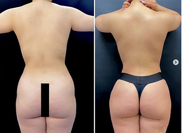Resultado de procedimiento anterior 4
